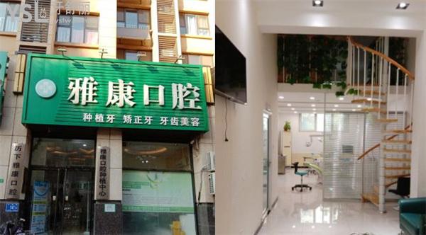 濟(jì)南雅康口腔種植牙好嗎