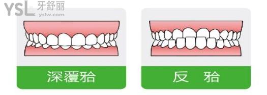植得口腔活動(dòng)