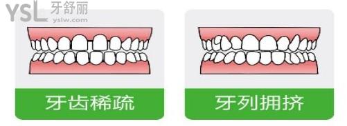 植得口腔活動(dòng)