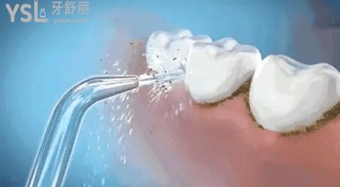 沖牙器