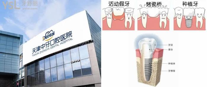 天津中諾口腔醫(yī)院和天津中牙口腔醫(yī)院比哪個好一些