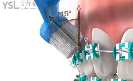 每次吃完東西必須要漱口嗎 為什么不建議立馬刷牙