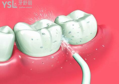 每次吃完東西必須要漱口嗎 為什么不建議立馬刷牙