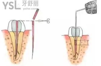 長沙口腔醫(yī)院價(jià)格表及口碑較好的牙科醫(yī)院排行榜
