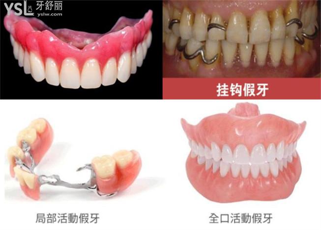 深圳鑲牙和植牙多少錢一顆 千元起的正規(guī)實惠牙科排行名單