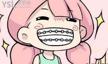戴上牙套后多久可以正常吃東西及如何正確的護(hù)理牙齒！.jpg