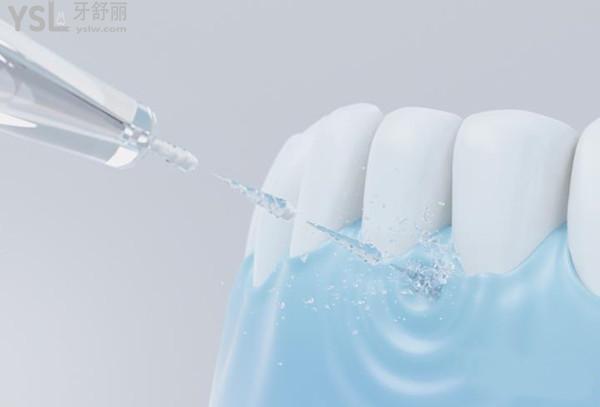 小米沖牙器