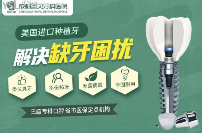 成都圣貝口腔種植優(yōu)勢(shì)