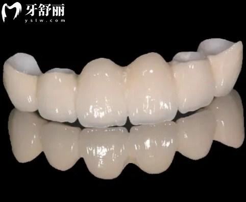 全瓷牙
