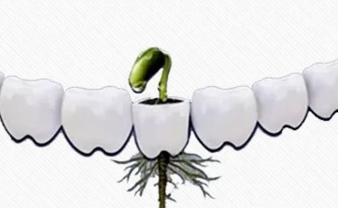 百康種植牙是哪個國的品牌