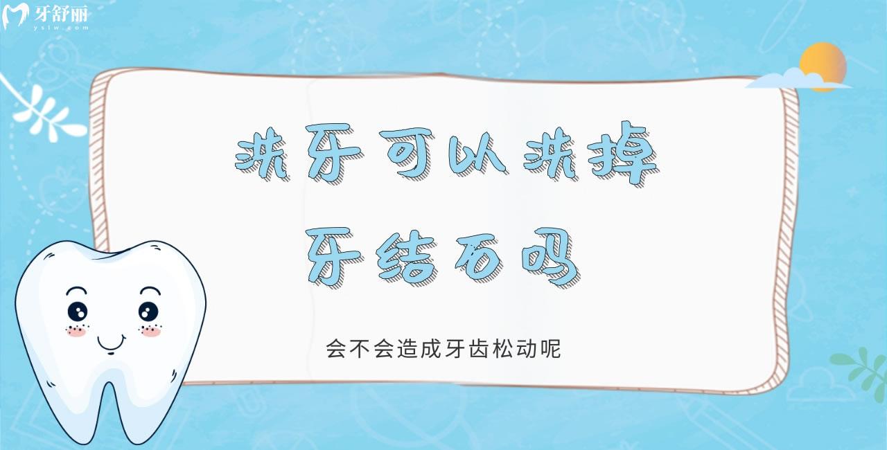洗牙可以洗掉牙結石嗎 會不會造成牙齒松動呢