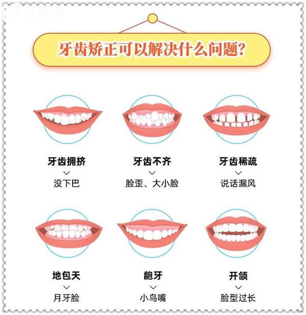 牙齒矯正