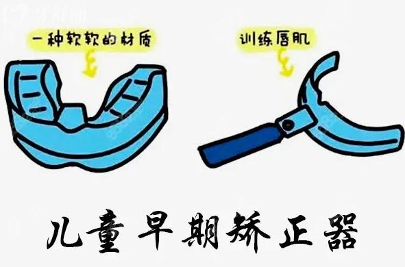 兒童早期矯正器