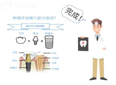 種牙必看！重慶種植牙好且正規(guī)醫(yī)院排名前十名單及收費(fèi)價(jià)格表