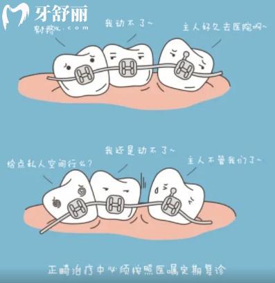 牙齒矯正會(huì)變牙套臉？帶牙套1~12月變化圖