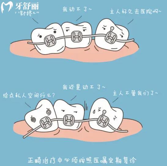 請問小孩牙齒矯正可以用隱適美牙套嗎？.jpg