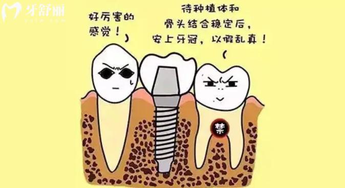 種植牙卡通圖