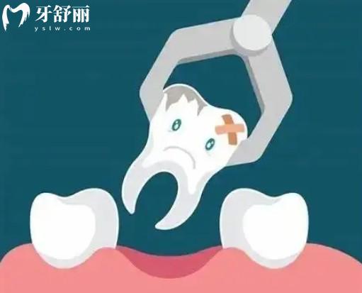 拔牙卡通圖