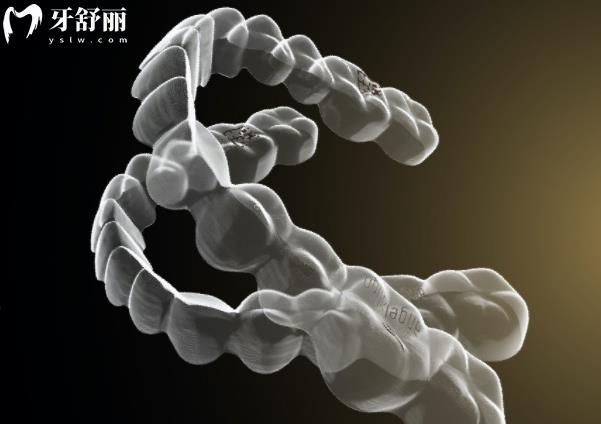 時(shí)代天使comfos為什么便宜 整理各不同型號(hào)價(jià)格和優(yōu)勢(shì)