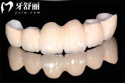 22-23年全新版上海牙科收費標(biāo)準(zhǔn)一覽 包含洗補(bǔ)拔整種牙價目表