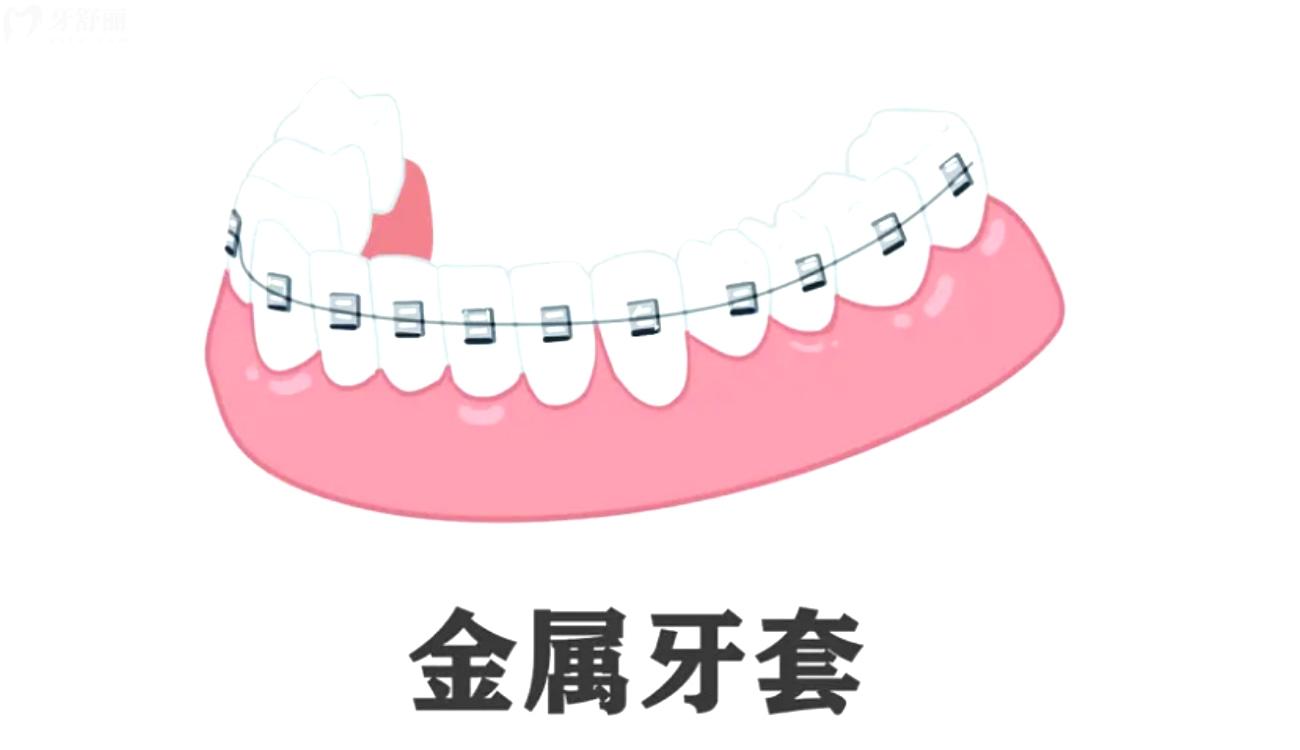 珠海牙科價(jià)格表.jpg