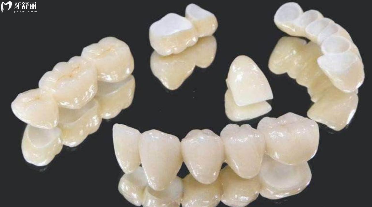 國產(chǎn)愛爾創(chuàng)全瓷牙價格多少錢一顆?全瓷牙800元是真的嗎?