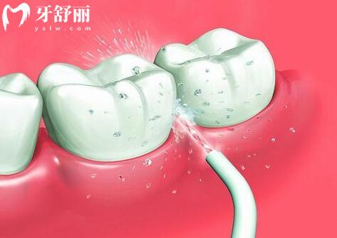 金華牙科醫(yī)院各牙科項目價格