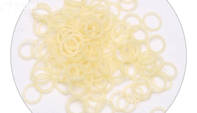 牙醫(yī)給的小皮筋有什么作用？麻煩不戴可以嗎？