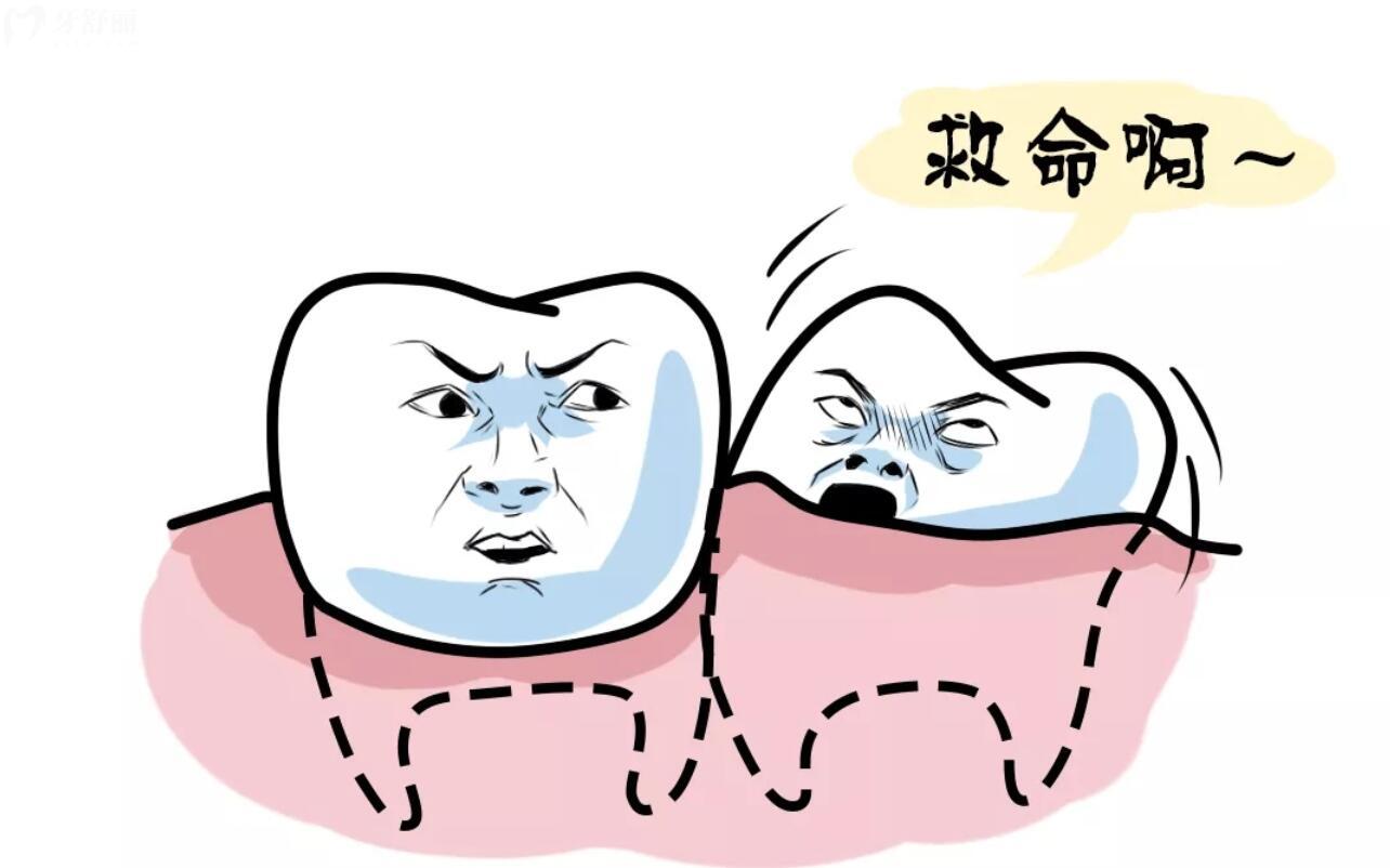 智齒拔出后空洞什么時候能長滿?。渴裁礃拥闹驱X難拔