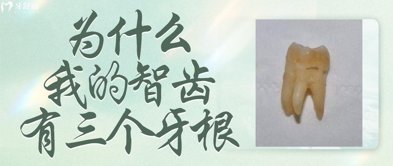 為什么我的智齒有三個(gè)牙根呢？正常嗎？