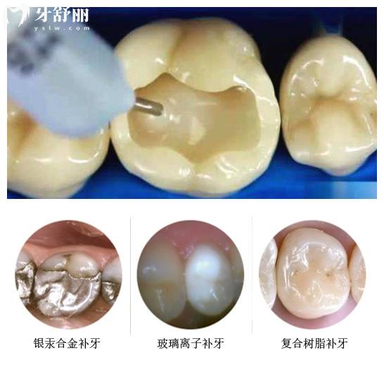 常州牙科醫(yī)院收費(fèi)標(biāo)準(zhǔn)