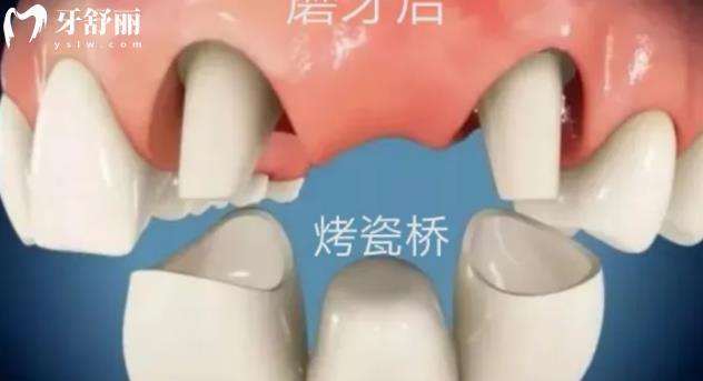 烏魯木齊牙科價(jià)格表