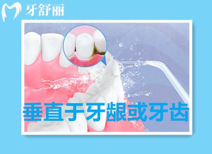 全新保定口腔收費(fèi)標(biāo)準(zhǔn)表格公布 包含洗/種/拔/補(bǔ)/整牙價目