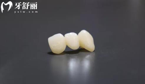 日本則武氧化鋯全瓷冠