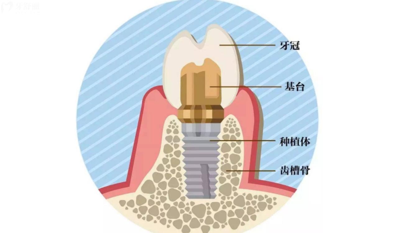 邢臺牙科收費(fèi)價(jià)目表揭曉.jpg