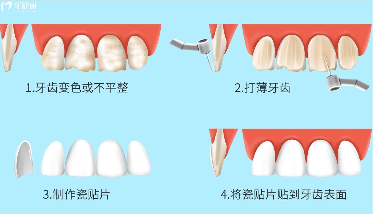 2023年蘭州看牙價(jià)格表分享.jpg