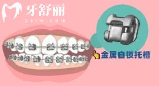 廣州牙齒矯正多少錢價格表2023