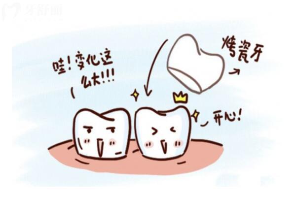 上海做義齒價格是多少?含烤瓷牙/吸附性義齒/種牙收費明細