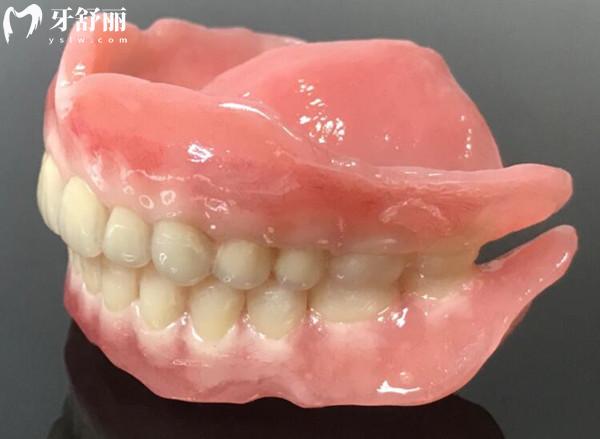 吸附性義齒