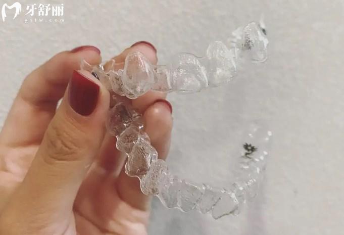 隱形矯正牙套