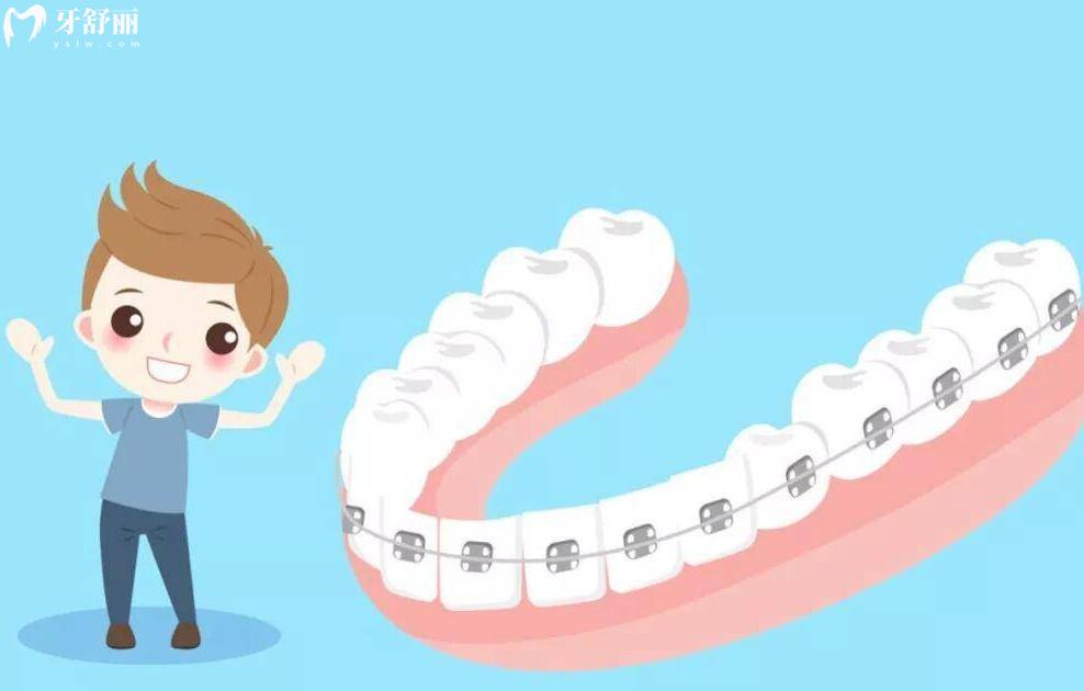 清遠(yuǎn)牙齒矯正價格