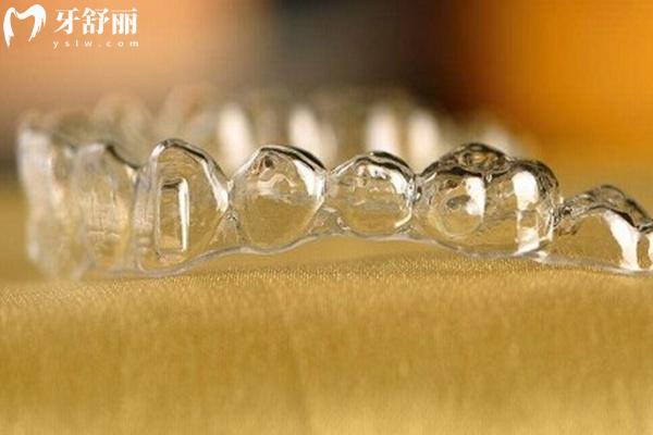 隱形矯正