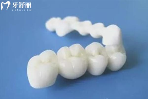 進(jìn)口全瓷牙冠