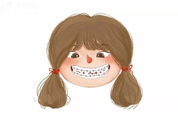 牙齒矯正卡通圖