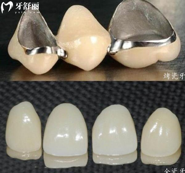 海南牙科醫(yī)院收費(fèi)標(biāo)準(zhǔn)已上線(xiàn),查詢(xún)新版種植/牙齒矯正/拔牙價(jià)格