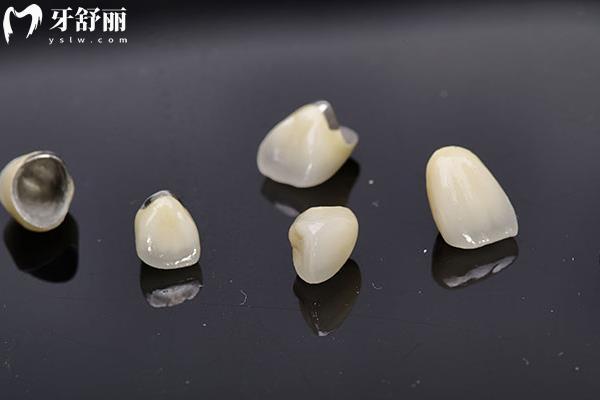 鑲牙