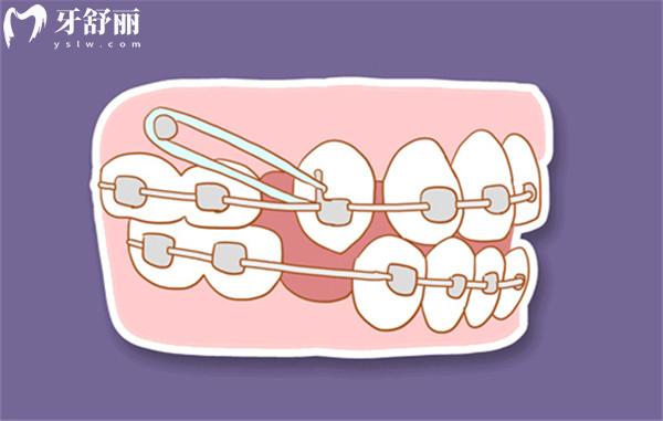 保山口腔醫(yī)院收費(fèi)標(biāo)準(zhǔn)表