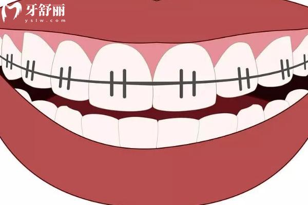 麗江口腔醫(yī)院價目表