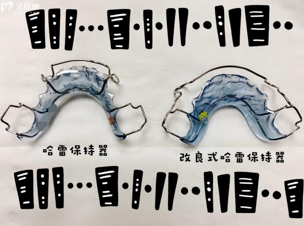 哈雷保持器型號