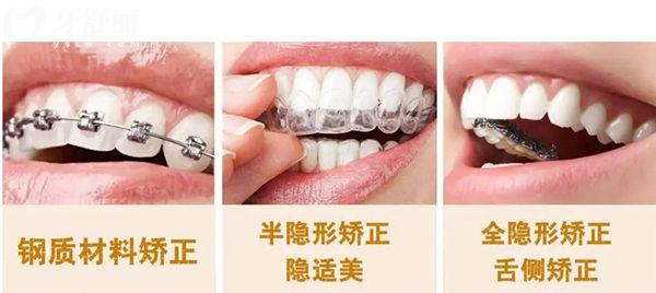 矯正圖